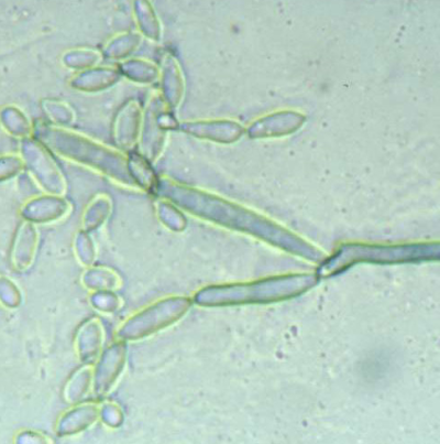 병원균(분생포자)