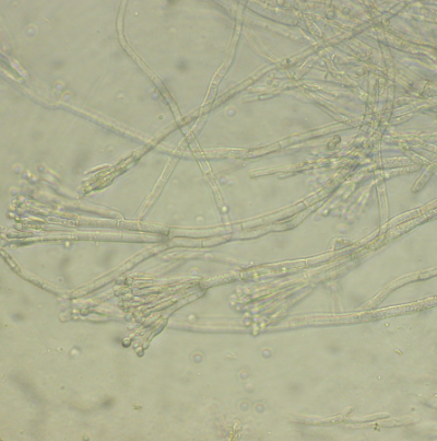 병원균(분생자경 및 분생포자)