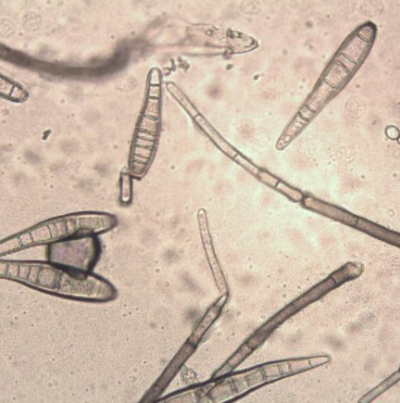 병원균(분생자경과 분생포자)
