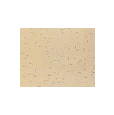 병원균(병포자)