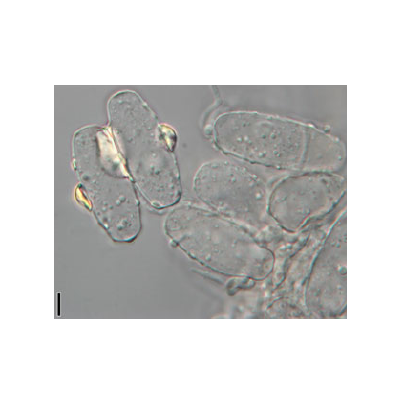 병원균(분생포자)