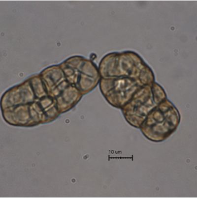 병원균(분생포자)