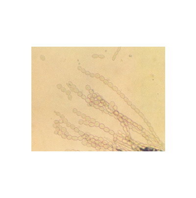 병원균(분생포자 사슬)