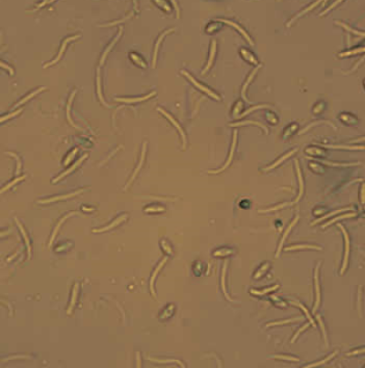 병원균(α포자와 β포자)