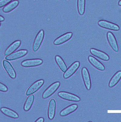 병원균(분생포자, Bar=30㎛)