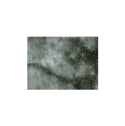 병원균(바이러스 입자)