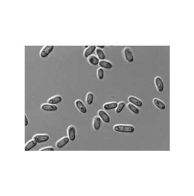 병원균(병포자)