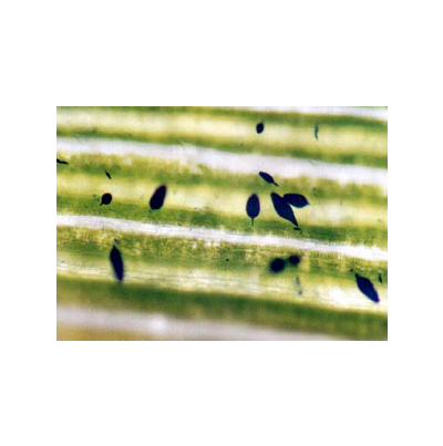 발병 잎 내부의 유주자낭