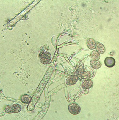 병원균(포자낭)