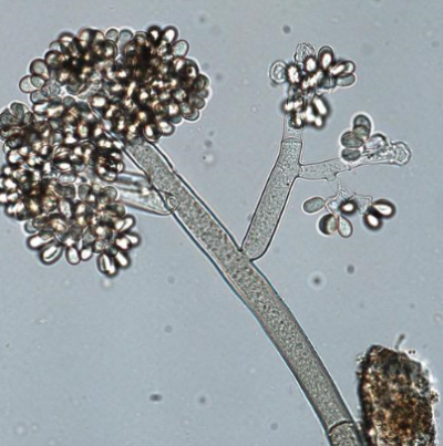 병원균(분생자경과 분생포자)