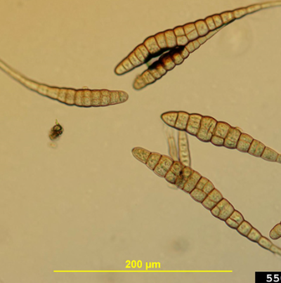 병원균(분생포자)