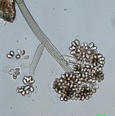 병원균(분생포자)