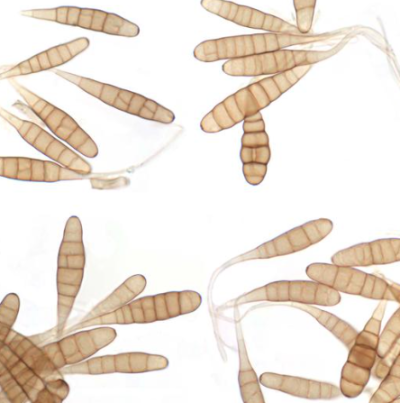 병원균(분생포자)