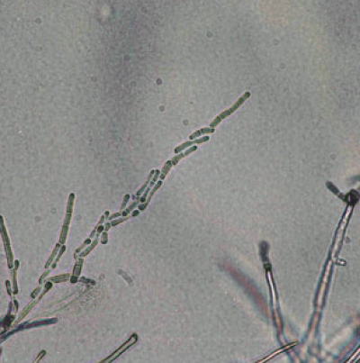 병원균(분절 포자)