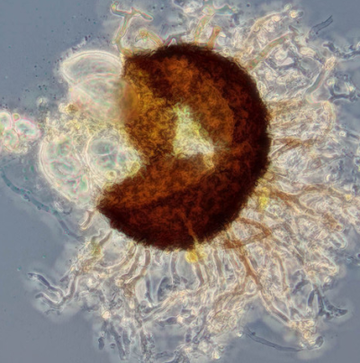 병원균(자낭각과 자낭) 