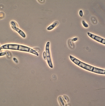 병원균(분생포자)