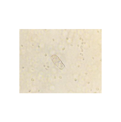 병원균(자낭 및 자낭포자)