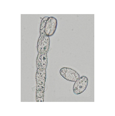 병원균(분생포자)