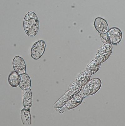 병원균(분생포자)