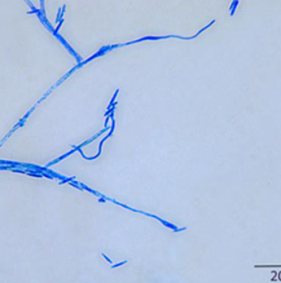 병원균(분생포자)