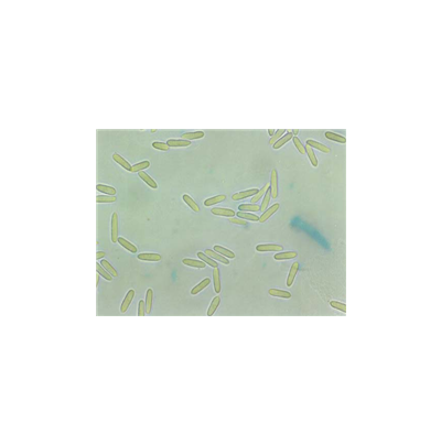 병원균(분생포자)     