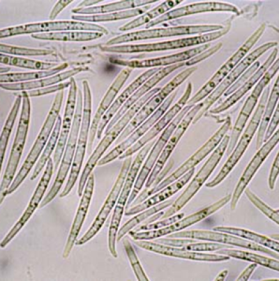 소형포자(해부현미경)와 대형포자(광학현미경)