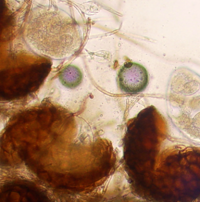 병원균(자낭각과 자낭포자)