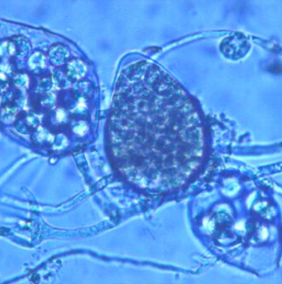 병원균(유주자낭)