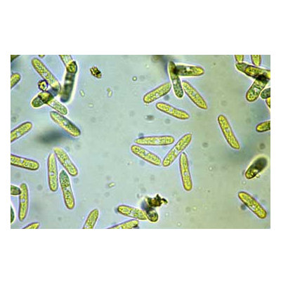 병원균(분생포자)