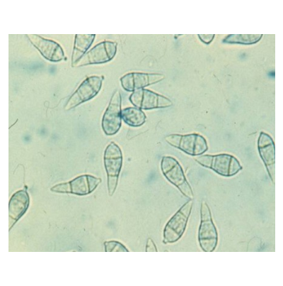 병원균(분생포자)