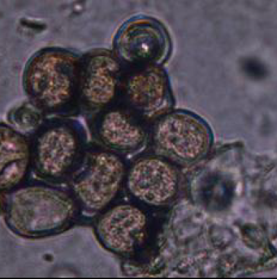 녹병 병원균 하포자