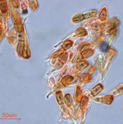 병원균(동포자)