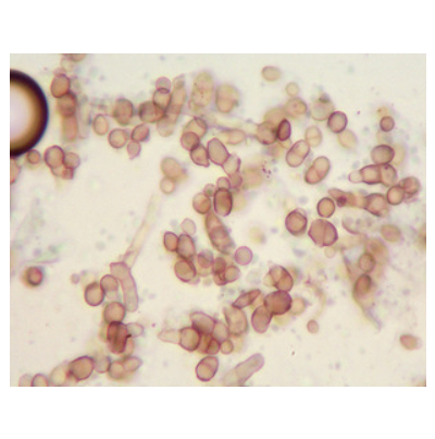 병원균(분생포자)