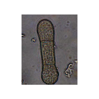 병원균(분생포자)