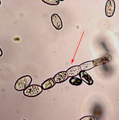 병원균(분생포자)