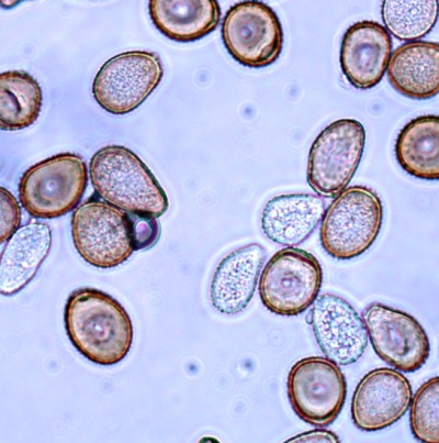병원균 (하포자)