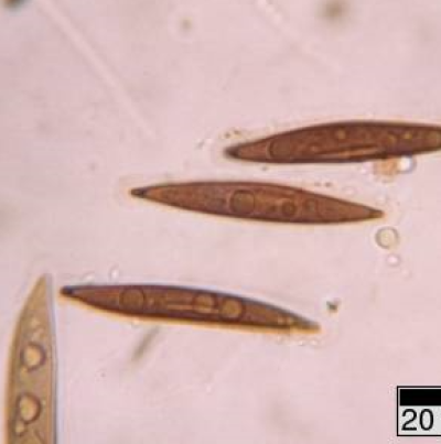 병원균(자낭포자)