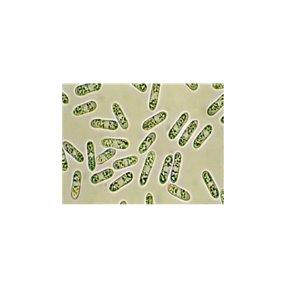 병원균(분생포자) 