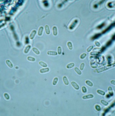 분생포자(투명포자)
