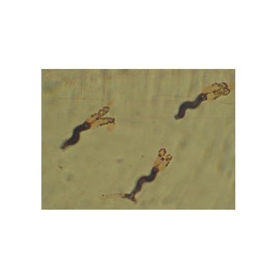 병원균(분생자경과 분생포자)