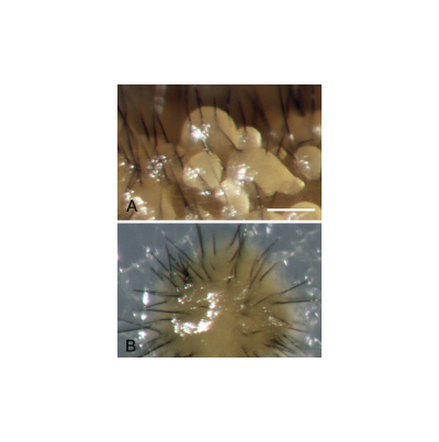 병원균(A-B 포자퇴와 강모)