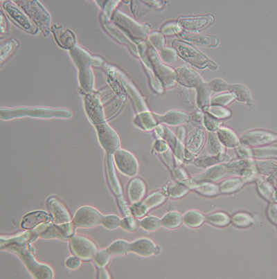 병원균(분생포자)