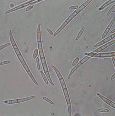 병원균 소형 및 대형분생포자(F. moniliforme)