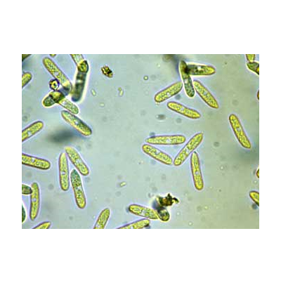 병원균(분생포자)