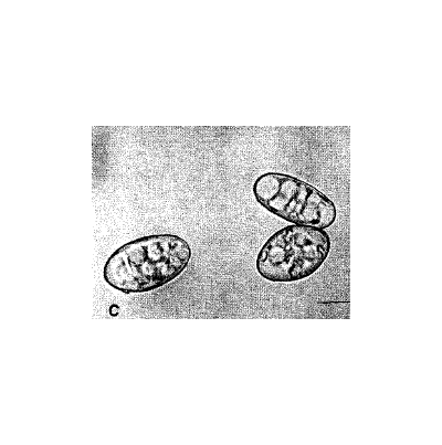 병원균(분생포자)