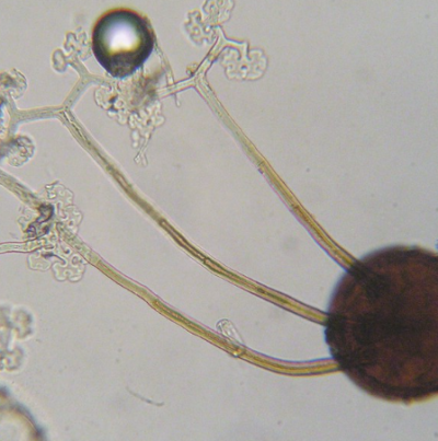 병원균(자낭각과 부속사)