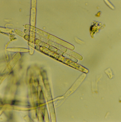 콩 검은뿌리썩음병 병원균 분생포자