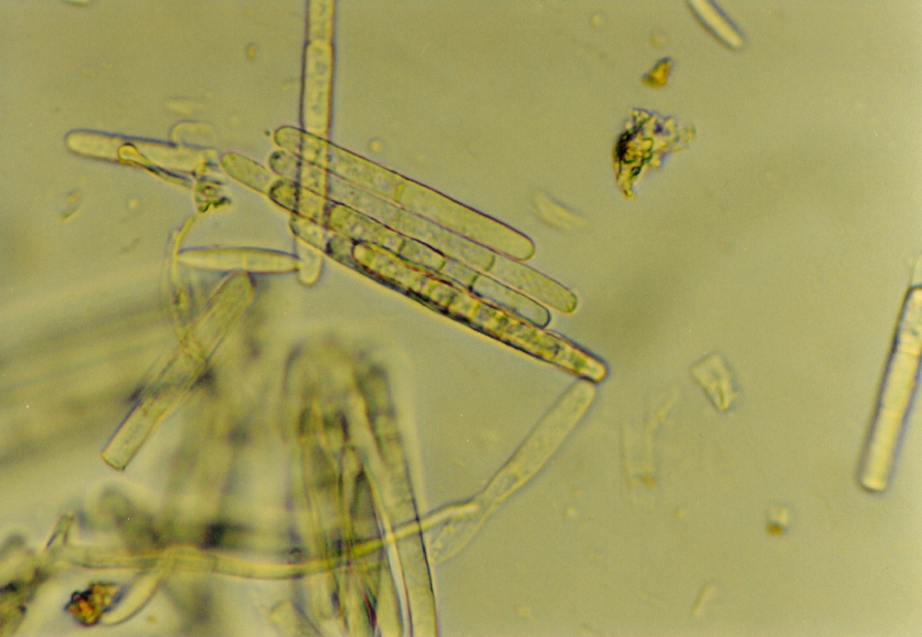 콩 검은뿌리썩음병 병원균 분생포자