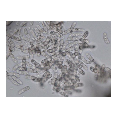 병원균(분생포자)