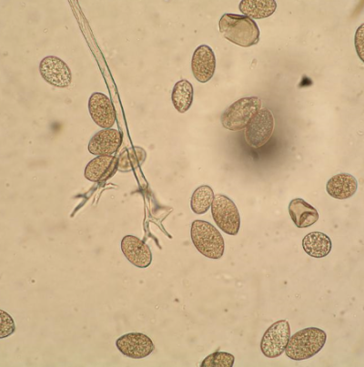 병원균(포자낭)